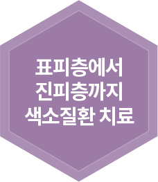 표피층에서 진피층까지 색소질환 치료