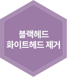 블랙헤드 화이트헤드 제거