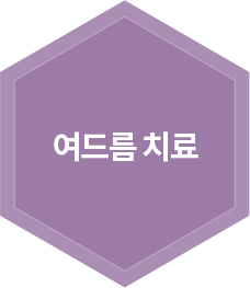 여드름 치료