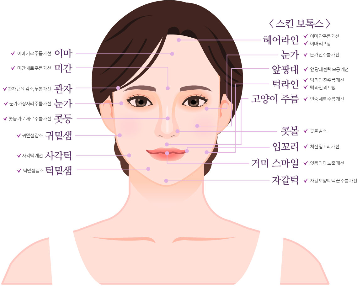 MDH 보톡스 시술부위 FACE