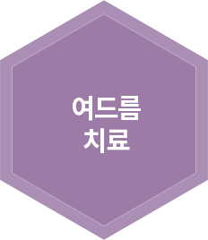 여드름 치료
