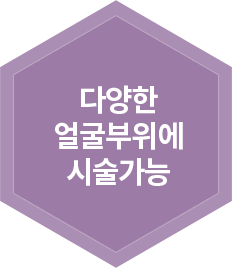 다양한 얼굴부위에 시술가능